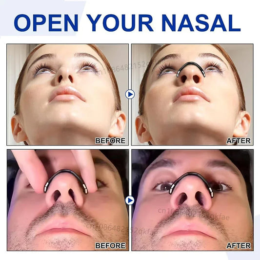 Magnetic Nasal Dilator